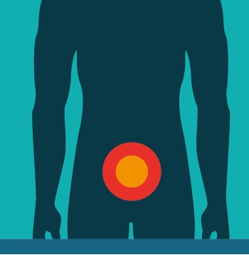 What is Male Pelvic Pain?